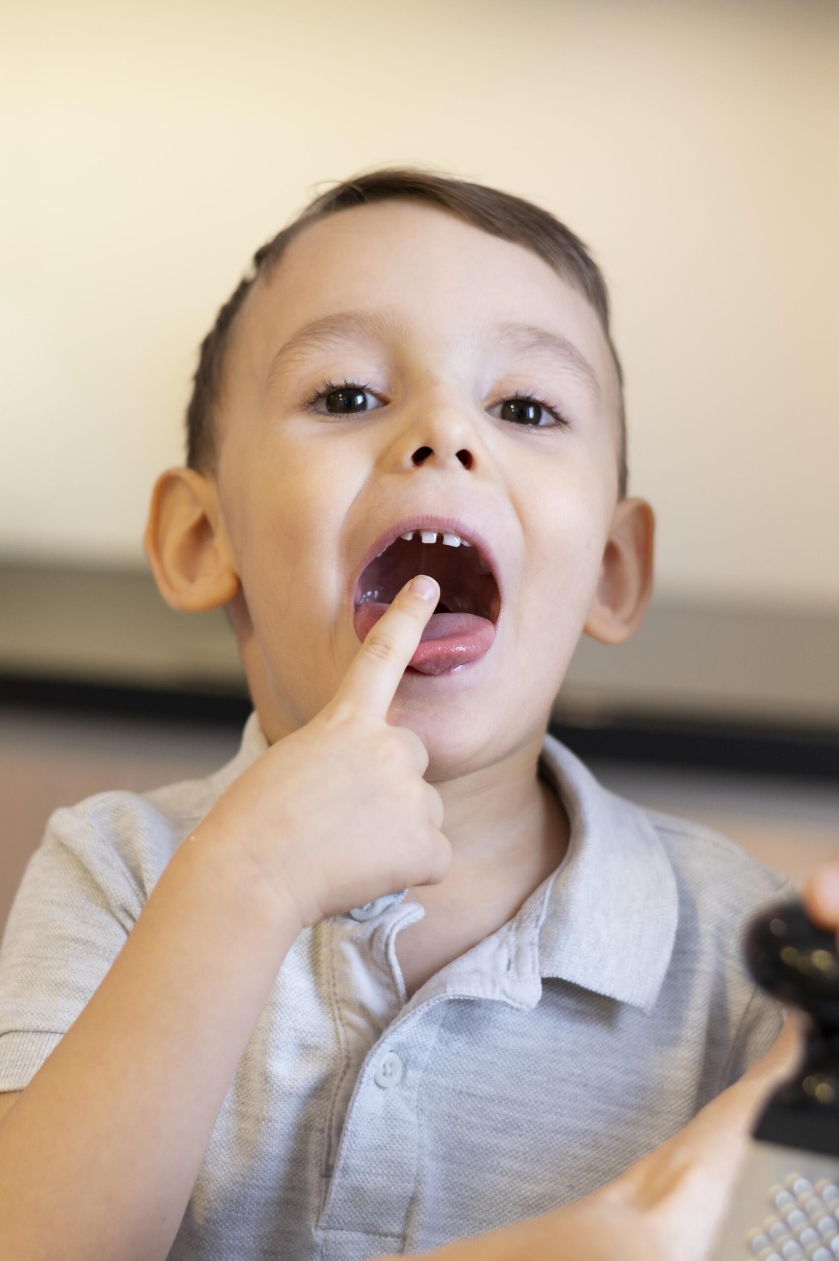 UNDERSTANDING TONGUE TIE IN CHILDREN