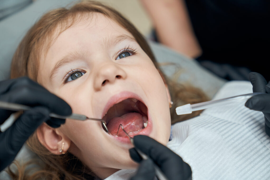 Tooth Extraction in Pediatric Dentistry: When Is It Really Necessary?